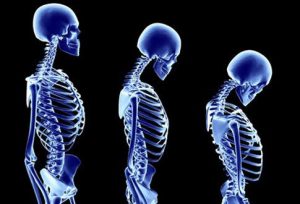 3 skeletons in a row showing different styles of posture