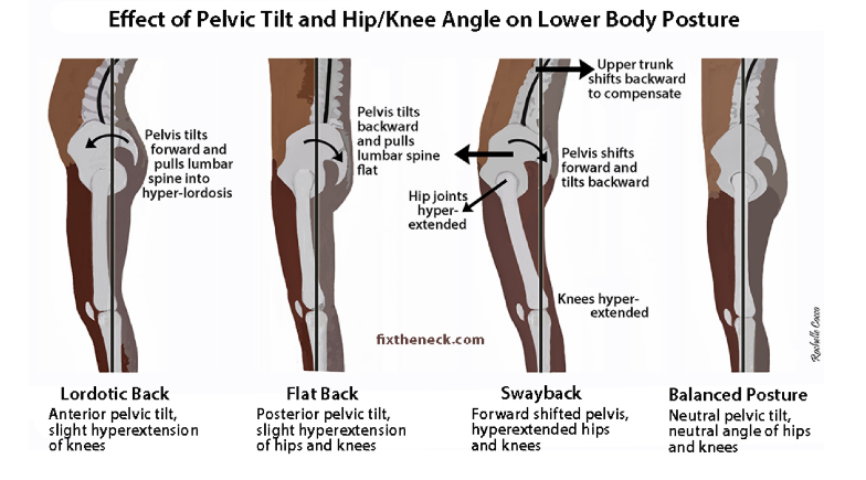 Pelvic Floor Muscles Causes Of Tight Pelvic Floor Muscles